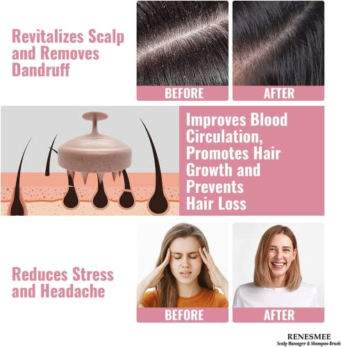 RENESMEE Scalp Massager Shampoo Brush, Eco-friendly Wheat Straw body with Soft Silicon Bristles, Hair Scalp Scrubber, Scalp Exfoliator | Dandruff Removal, Prevents Hair loss (Pink) - Image 4